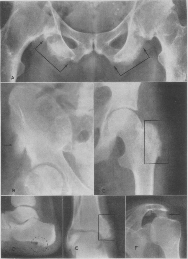 Fig. 11