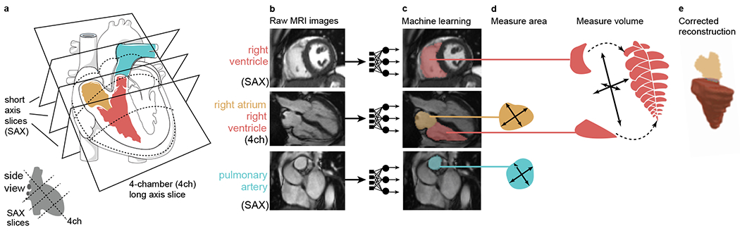 Figure 1 |