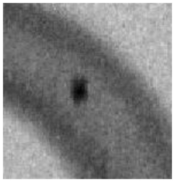 Figure 18