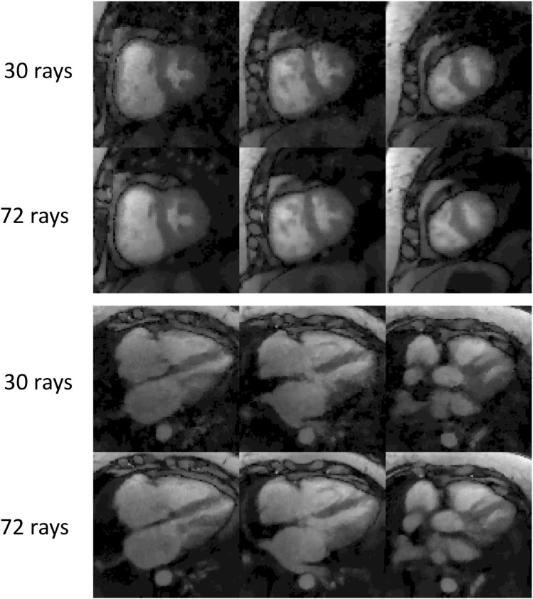 Fig 14