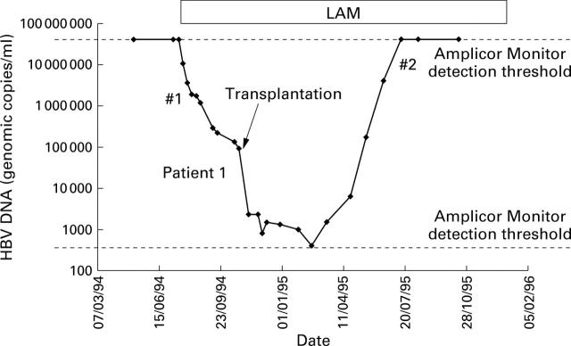 Figure 1  