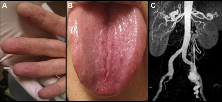 Fig 1