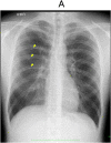 Fig. 1A