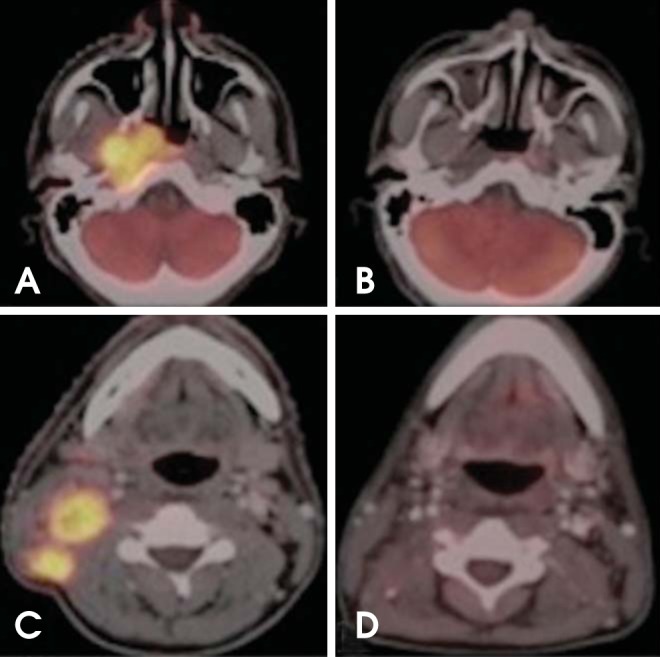 Fig. 9