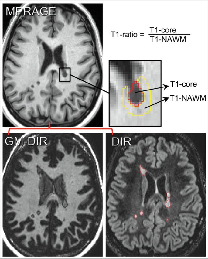 Fig 1.