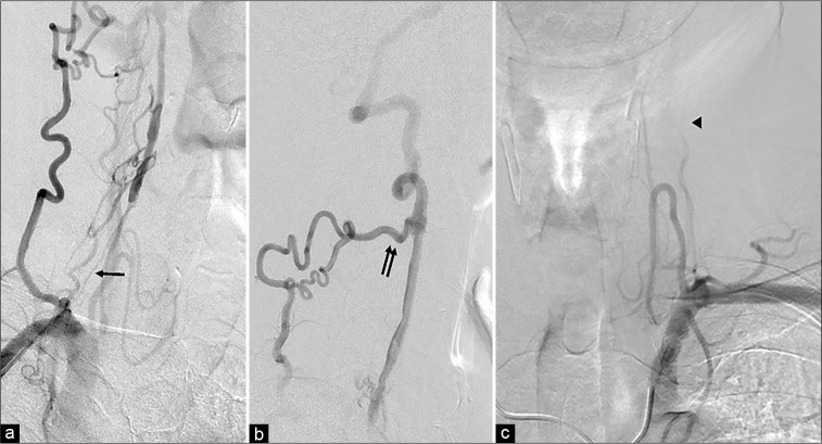 Figure 2: