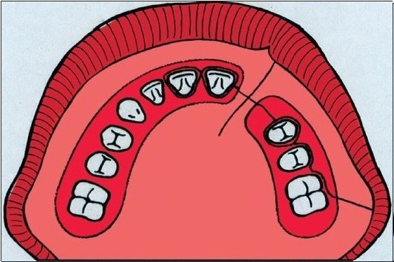 Figure 2A