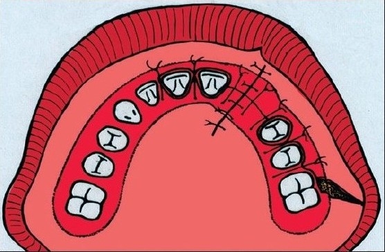 Figure 2D