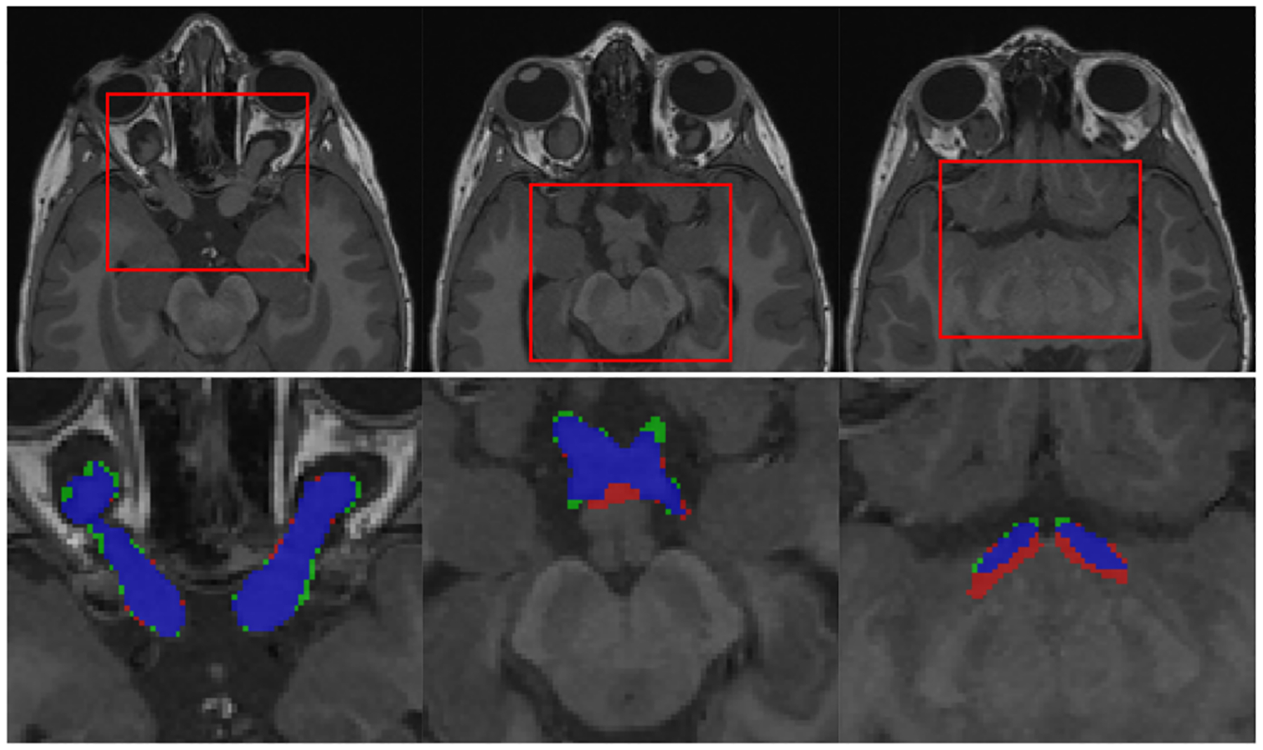 Fig. 2.