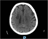 Fig. 2c