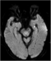 Fig. 4a