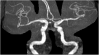 Fig. 4b