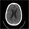 Fig. 3a