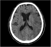 Fig. 1a