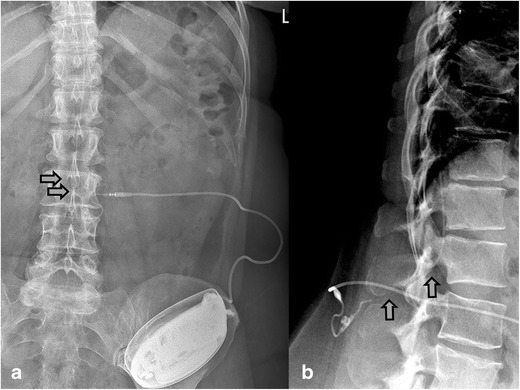 Fig. 10