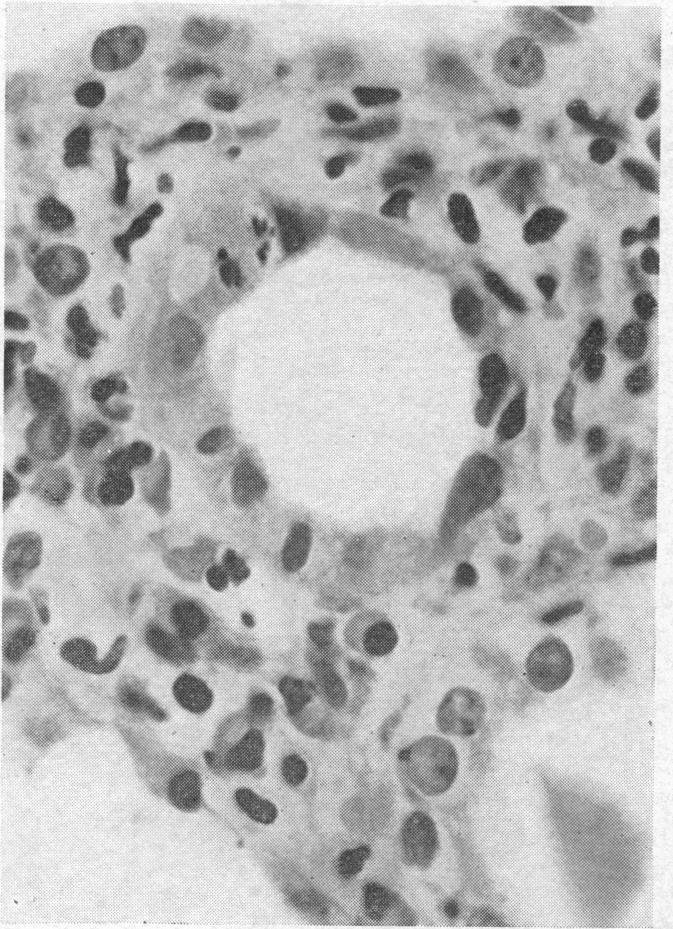 Fig. 1.-Case 5