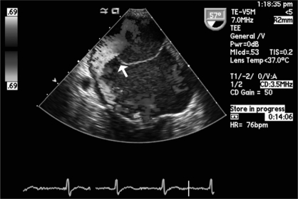 Figure 2)