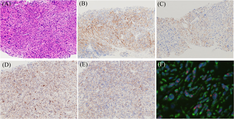 Figure 1