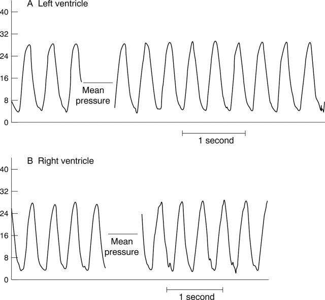 Figure 1  