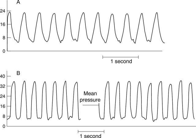 Figure 4  