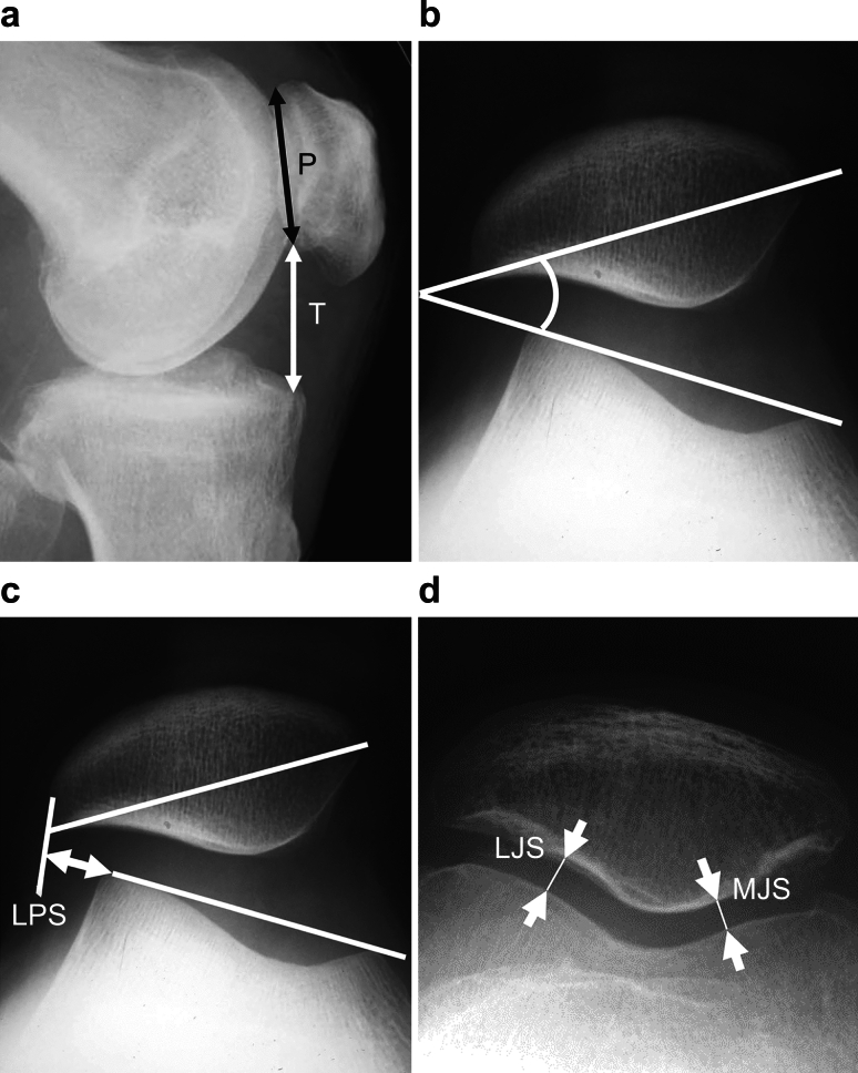 Fig. 1