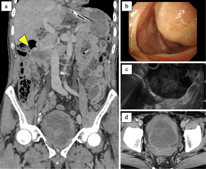 Figure 2.