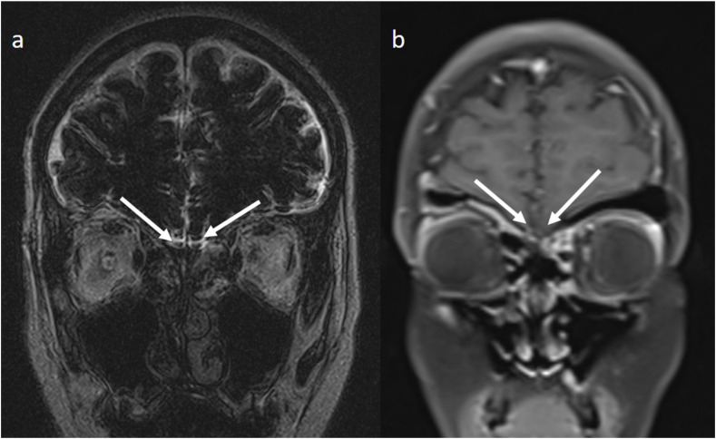 Fig. 1a/b