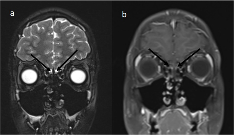 Fig. 2a/b