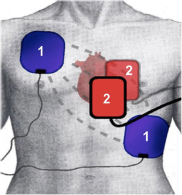 Fig. 1