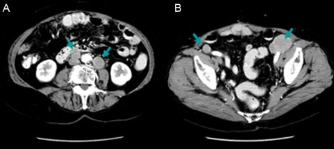 Fig. 2