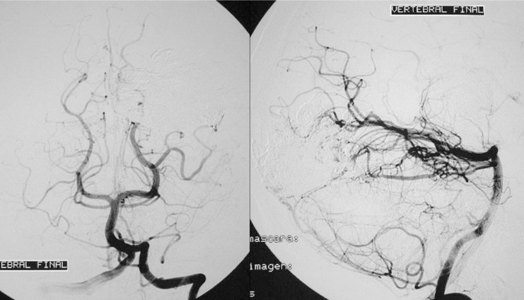 Figure 18