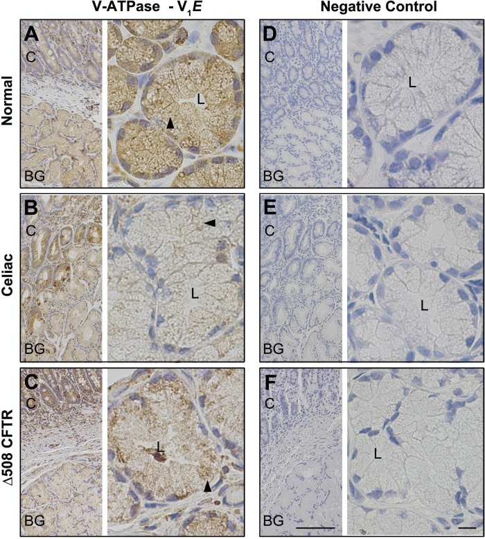 Fig. 11.