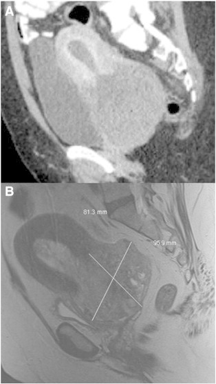 Fig. 1