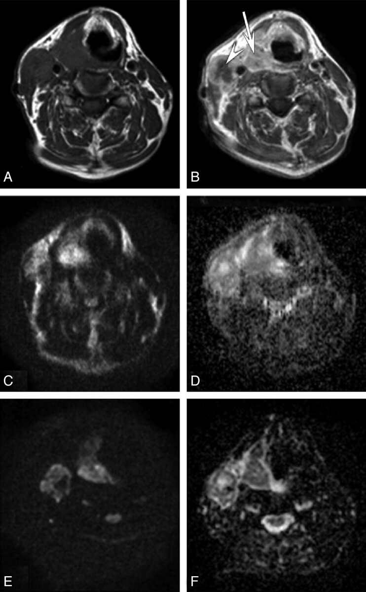 Fig 2.