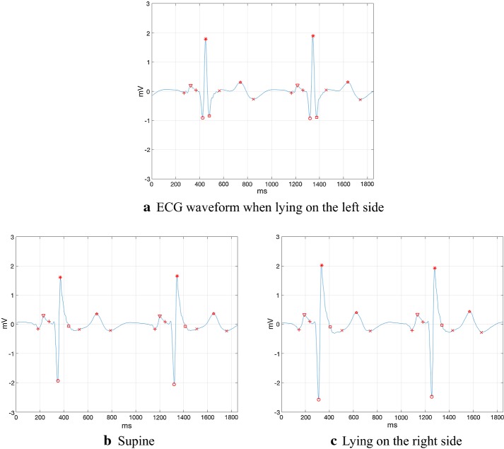 Fig. 4