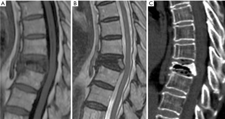 Figure 55