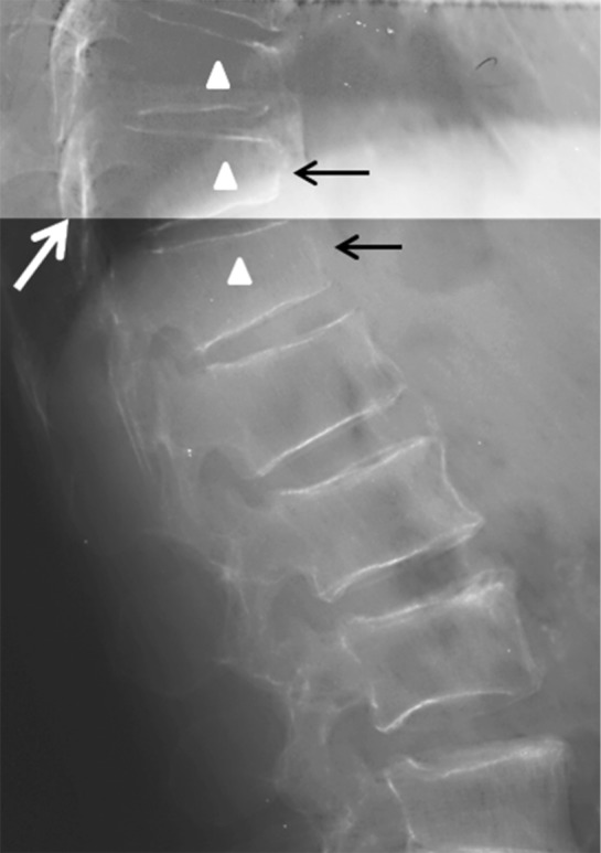 Figure 41