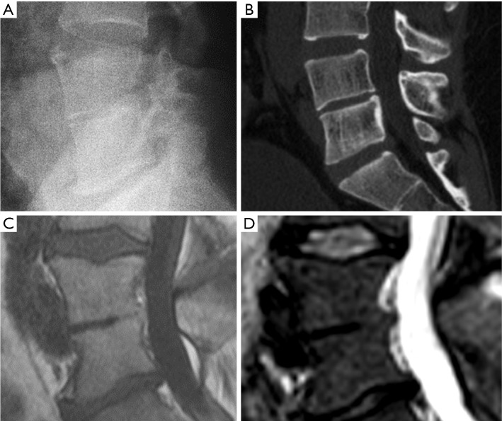 Figure 38