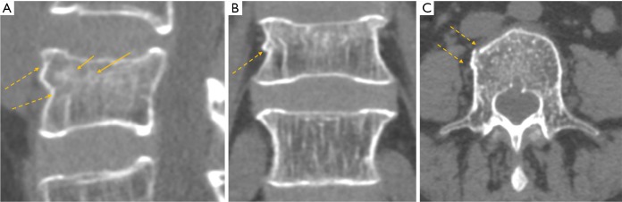 Figure 22