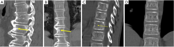 Figure 27