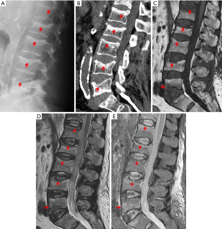 Figure 25