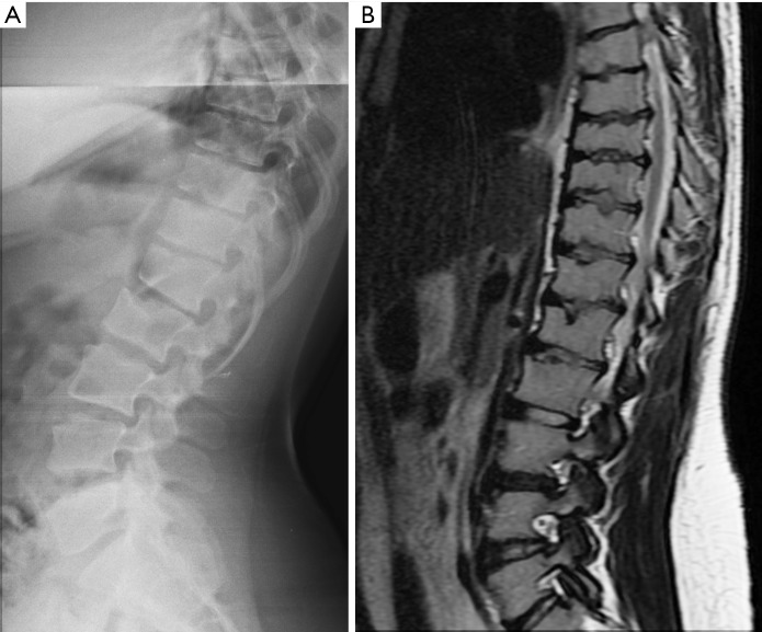 Figure 29