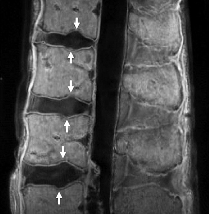 Figure 51