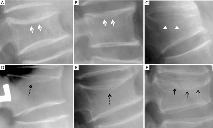 Figure 21