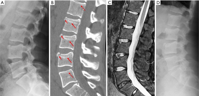 Figure 52