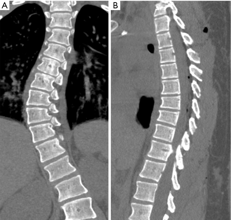 Figure 34