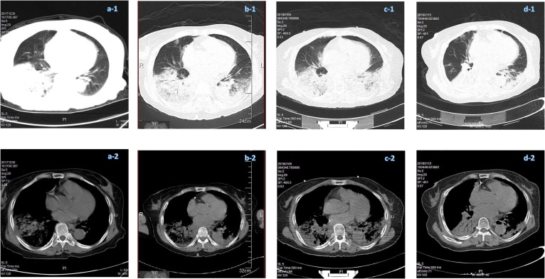 Fig. 2