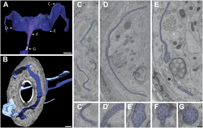 Figure 11.