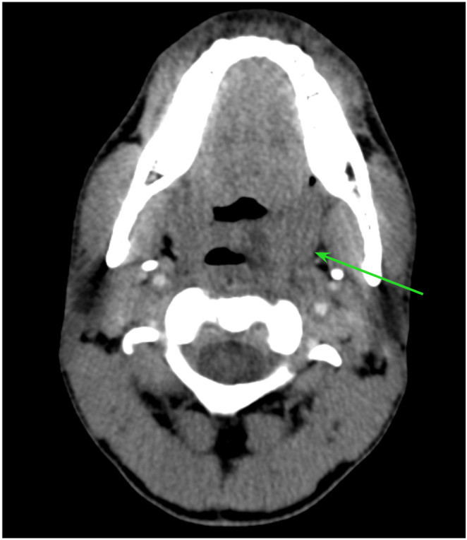 FIGURE 1