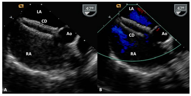 Figure 9